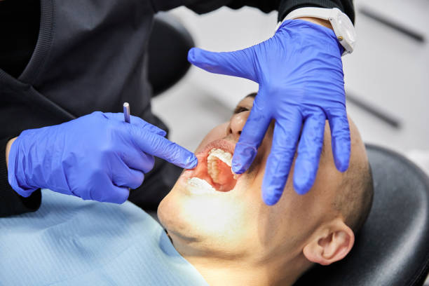 Best After-Hours Dental Trauma Care in Canyon Creek, WA
